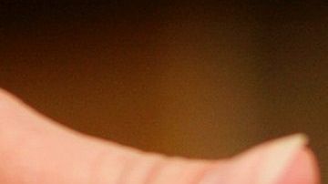 El tipo de sangre puede ser un factor.