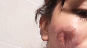 Lucero Velasco San Juan muestra el daño en su rostro.