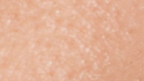 Algunos influencers han recomendado esta acción que resulta muy dañina para tus dientes.