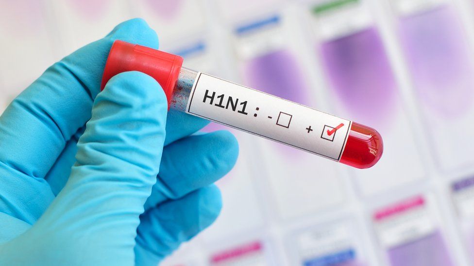 La pandemia de H1N1 afectó a más de 200 países entre 2009 y 2010.