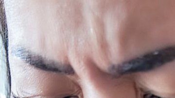 La somatización se define como "la manifestación de síntomas físicos de un problema psicológico".