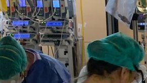 La respiración extracorpórea está salvando vidas durante la pandemia de covid-19.