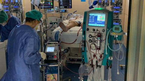La respiración extracorpórea está salvando vidas durante la pandemia de covid-19.