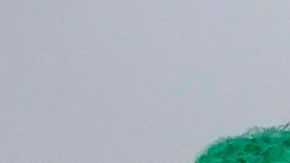 De seguro, estás cometiendo muchos de estos errores con la esponja de cocina.