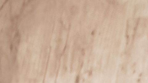 A veces hay que buscar ayuda del terapista para liberar estrés.