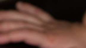 Los niños son especialmente vulnerables al sarampión. (archive)