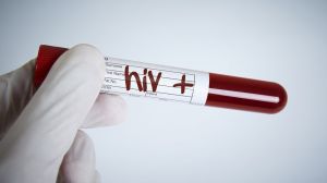 Qué lecciones nos dejó el sida, la "peor pandemia de finales del siglo XX", para hacer frente al coronavirus