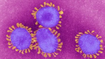 El SARS-CoV-2 ha sido catalogado como un virus con potencial endémico por la OMS.