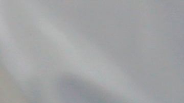 Hasta ahora la fiebre es considerada uno de los primeros síntomas del coronavirus 2019-nCoV.