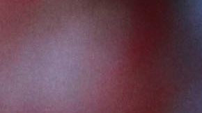 El aerosol de los árbitros.