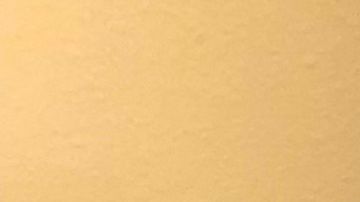 Víctor Espinoza se recupera de fractura de cuello en su casa de Del Mar, California.