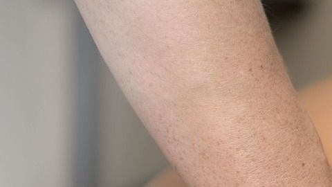 dolor de espalda