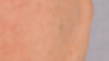 Dicho malestar lo tuvo una joven italiana que dio positivo a covid-19.