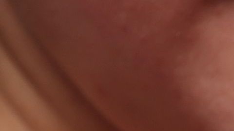 eczema