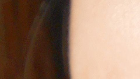 llaga boca