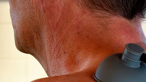 El hombre estuvo más de dos meses internado.