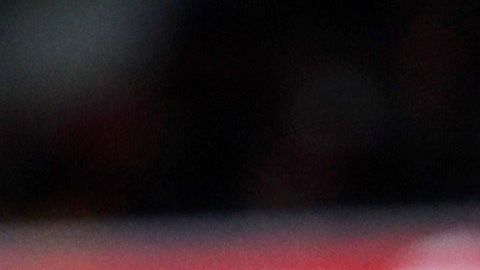 De ser operado Diego Costa podría estar hasta tres meses fuera de la competición.