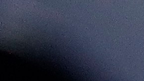 El coronavirus es capaz de matar a las células cardíacas.