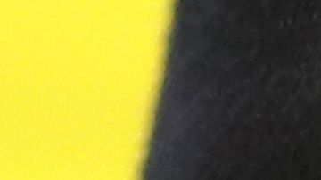 Marcell Ozuna denunció que tuvo lesiones leves en la cara.