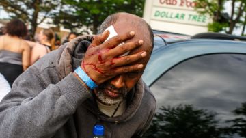 Manifestante herido por un proyectil de la Policía en Minneapolis.