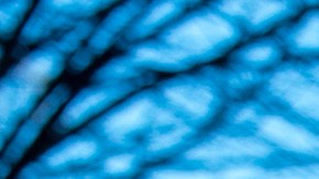 La ex concejal participa en un duelo electoral con 11 aspirantes a ocupar una curul en Washington.