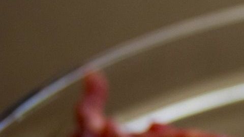 E. Coli puede causar deshidratación, diarrea y dolores abdominales.