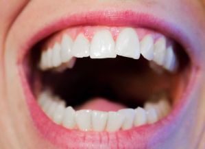 Salud bucal: ¿Qué es la periodontitis y cuáles son sus tratamientos?