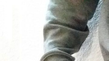 El hombre estuvo intubado durante dos semanas.