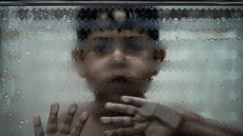 El pequeño era severamente castigado por su padrastro.