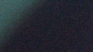 pulmones radiografía