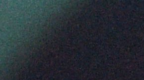 pulmones radiografía