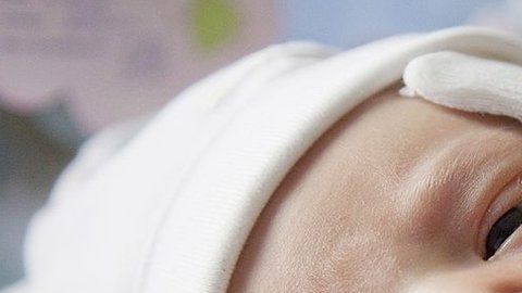 Los fórceps pueden provocar lesiones en el recién nacido.