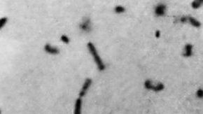 La peste bubónica se caracteriza por la inflamación de los ganglios linfáticos