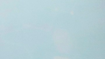 Pocos doctores notan este síntoma por falta de revisión.