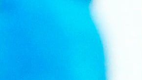 David Ospina tuvo que salir de cambio al minuto 28 del partido.