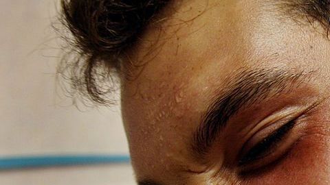 A través de la comida los afectados buscan compensar la sensación de angustia, miedo o ansiedad.