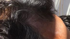 Las alcantarillas se han convertido en una fuente de relevante material de estudio científico.