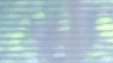 Un paciente es tratadio por coronavirus en California.