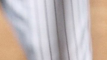 Masahiro Tanaka seguirá en observación y su pronóstico es favorable.