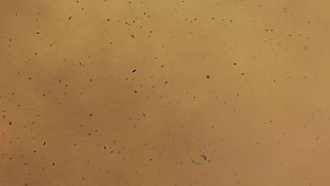 Incendio Amazonas Brazil Brasil