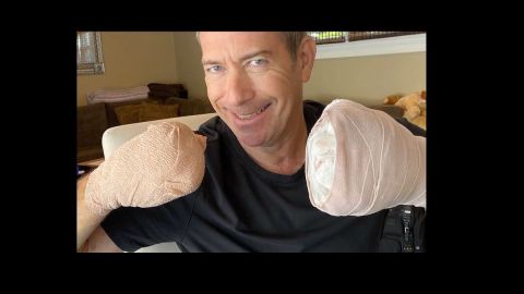 gregg garfield