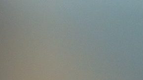 Tuvo una reacción alérgica que hizo que su cara se viera cuadrada.