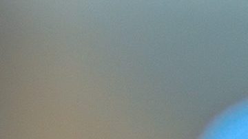 Tuvo una reacción alérgica que hizo que su cara se viera cuadrada.