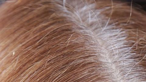 canas