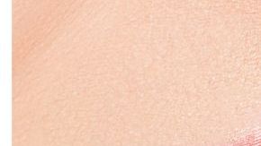 blanqueamiento dientes