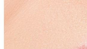 blanqueamiento dientes