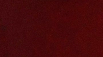 Ter Stegen fue intervenido de manera exitosa.