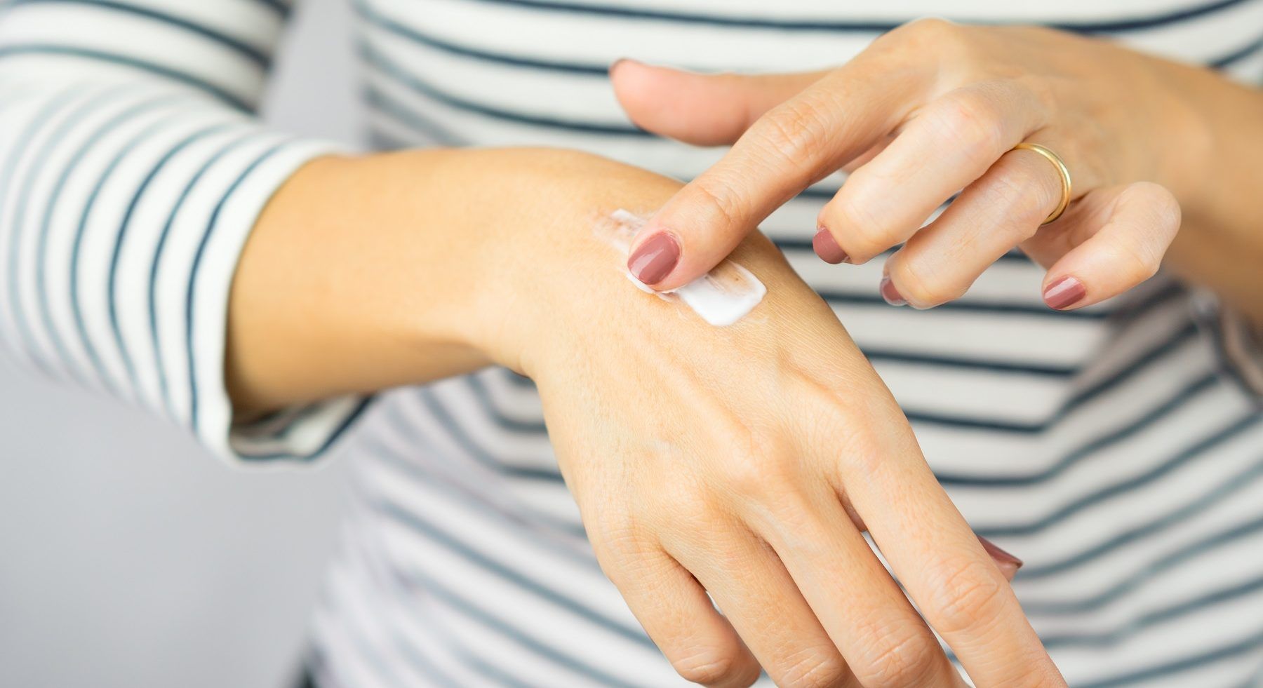 Las 4 mejores cremas cicatrizantes para curar rápidamente tus heridas Las 4 mejores cremas cicatrizantes para curar rápidamente tus heridas