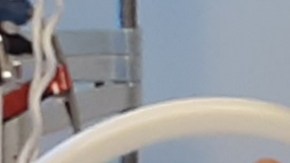 Erika Murcia muere esperando un trasplante de hígado para poder vivir.