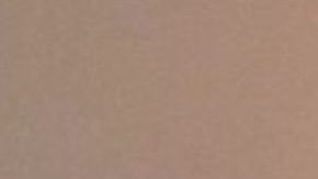 El señor Alfredo Rogel de 62 años con moretones en su rostro.